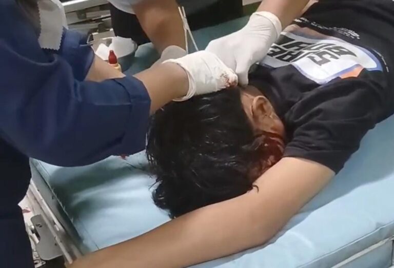 Nonton Orkes Dangdut di Desa Srikaton, Dua Orang Warga Pati Jadi Korban Pengeroyokan