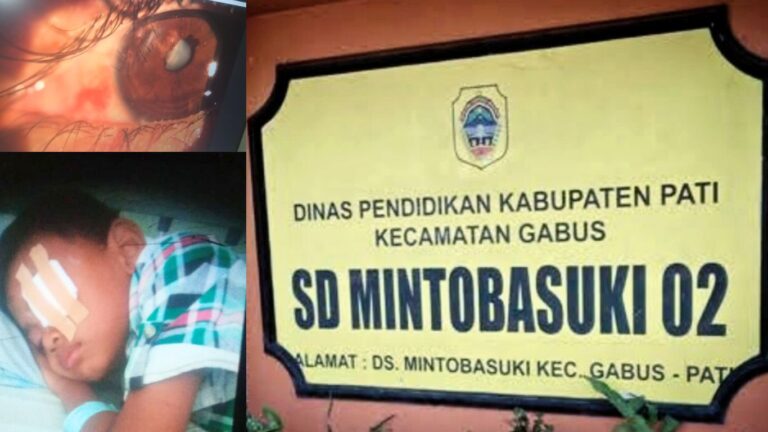 Buntut Kasus Bully Hingga Siswa Cedera Mata di SD Mintobasuki 02-Pati, Orang Tua Korban Layangkan Somasi ke Sekolah dan Akan Menempuh Jalur Hukum